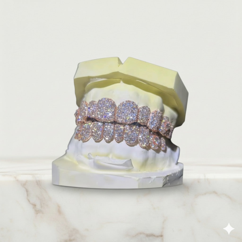 So Icy Diamond Grillz - Custom