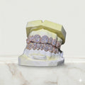So Icy Diamond Grillz - Custom