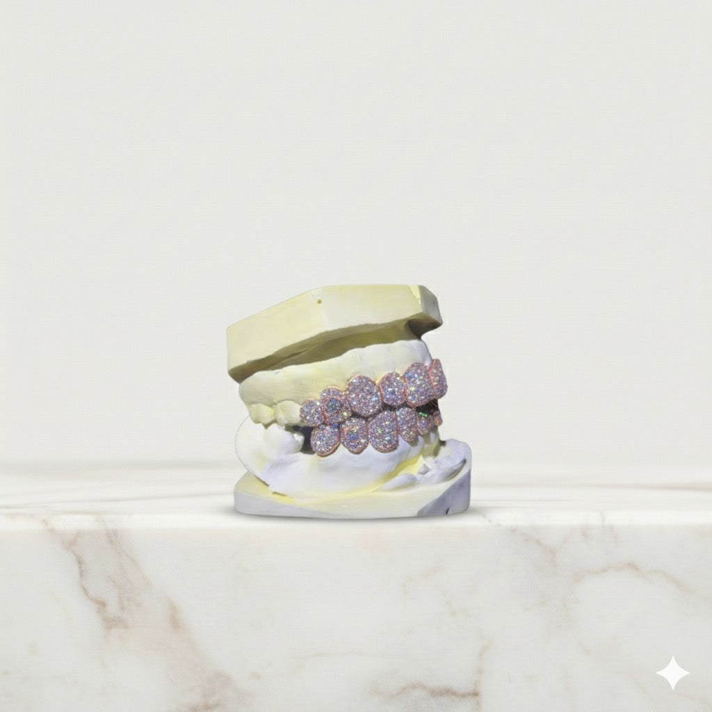 So Icy Diamond Grillz - Custom